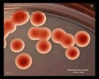 Klebsiella pneumoniae on Mac Conkey agar